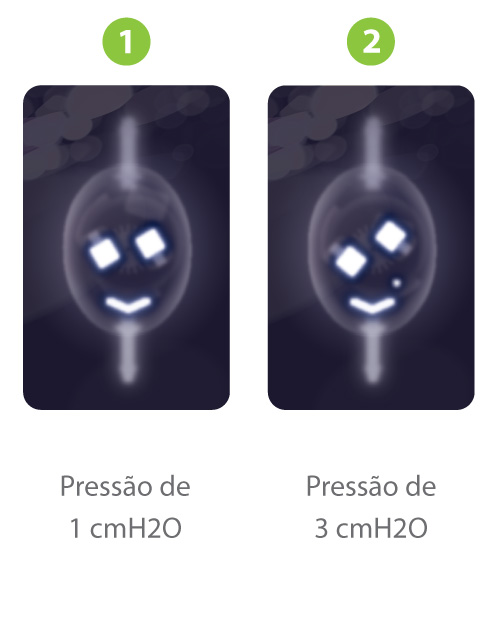 Sphera-Pro-Raio-X-A