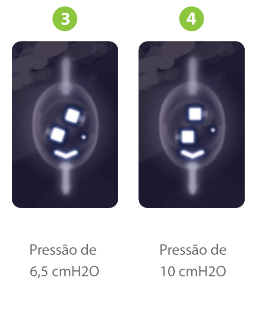 Sphera-Pro-Raio-X-B