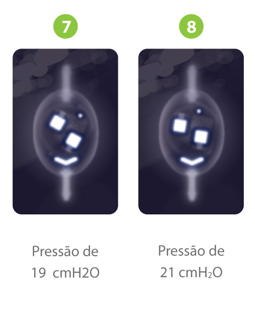 Sphera-Pro-Raio-X-D